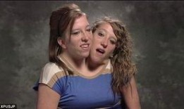 连体在线观看,生死相依的感人故事